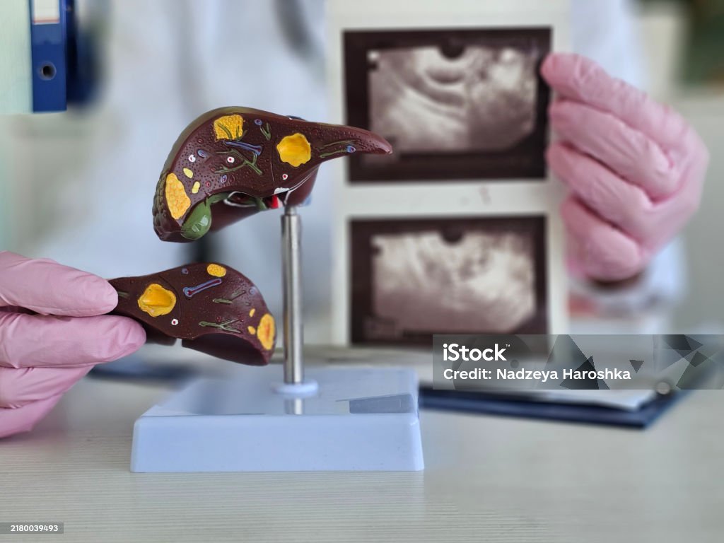 فحص وظائف الكبد